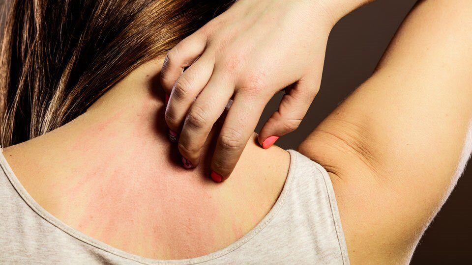 Что делать при раздражении кожи: комплексные рекомендации